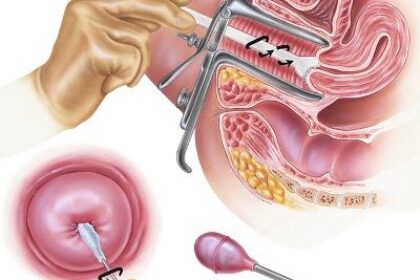 Outras Aplicações Essenciais