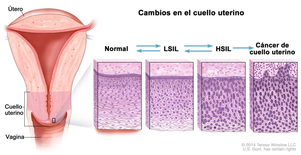 Como a Citologia Ajuda no Diagnóstico Precoce de Doenças